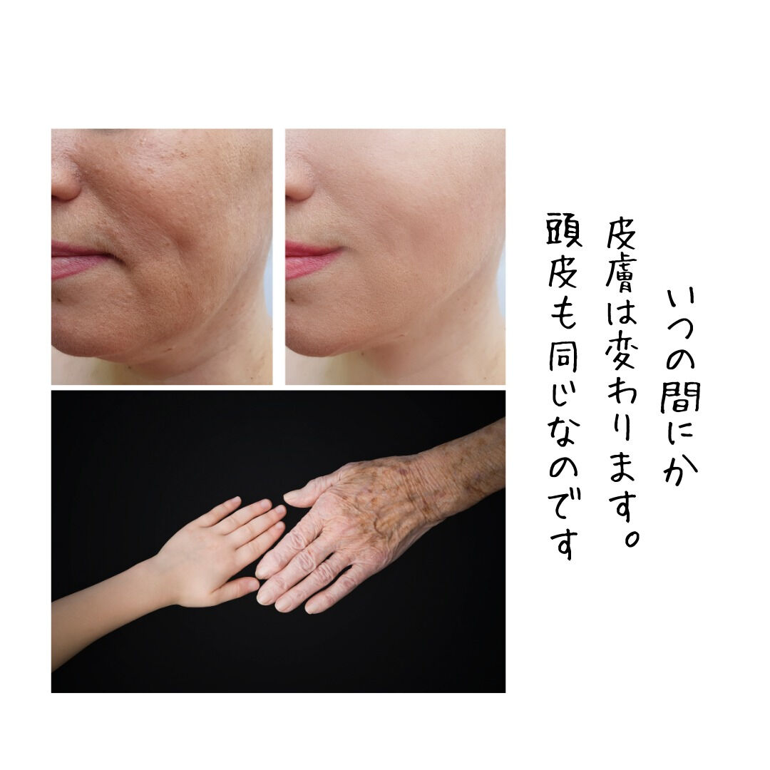 「頭皮も同じ“皮膚”です